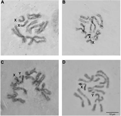 The Chromosomes of Zeugodacus tau and Zeugodacus cucurbitae: A Comparative Analysis